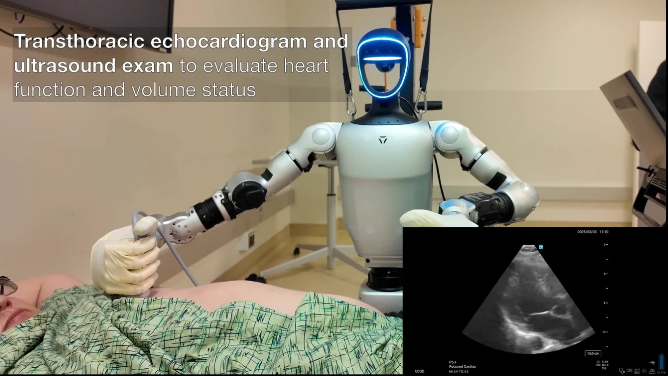 Atenção, Médicos: Robôs Humanoides com IA da China Podem Mudar Sua Profissão! 6 Um robô médico realizando um ecocardiograma em um paciente, com uma imagem de ultrassom do coração visível.
